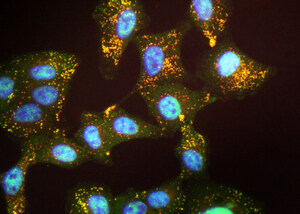 Experimental Drug Targets Nucleus of Allergen-Sensitized Cells