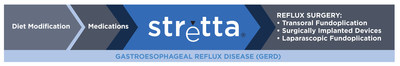 Stretta is a non-surgical treatment option for GERD that is an option for patients when symptoms persist despite medications. It is a versatile option that addresses the special needs of chronic GERD patients like: Patients whose GERD symptoms don't respond to PPIs, patients who are concerned about taking medications long-term, patients with GERD post-bariatric procedures, patients with respiratory symptoms of GERD (LPR), and patients who still have GERD post-fundoplication or other anti–reflux surgery. Importantly, Stretta does not preclude any other treatment option.