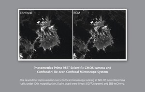 Photometrics® and Confocal.nl Announce a New Collaboration in Sub Diffraction-Limited Confocal Microscopy