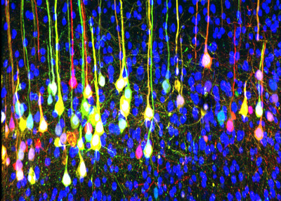 This image uses viral tracing to map connected neurons for an antagonistic muscle pair in a Bax/Bak double mutant adult mouse. Researchers report in the journal Neuron that molecular signaling from the Bax/Baks pathway is important for maturing mice to develop synergistic connections between the brain and opposing muscle pairs.