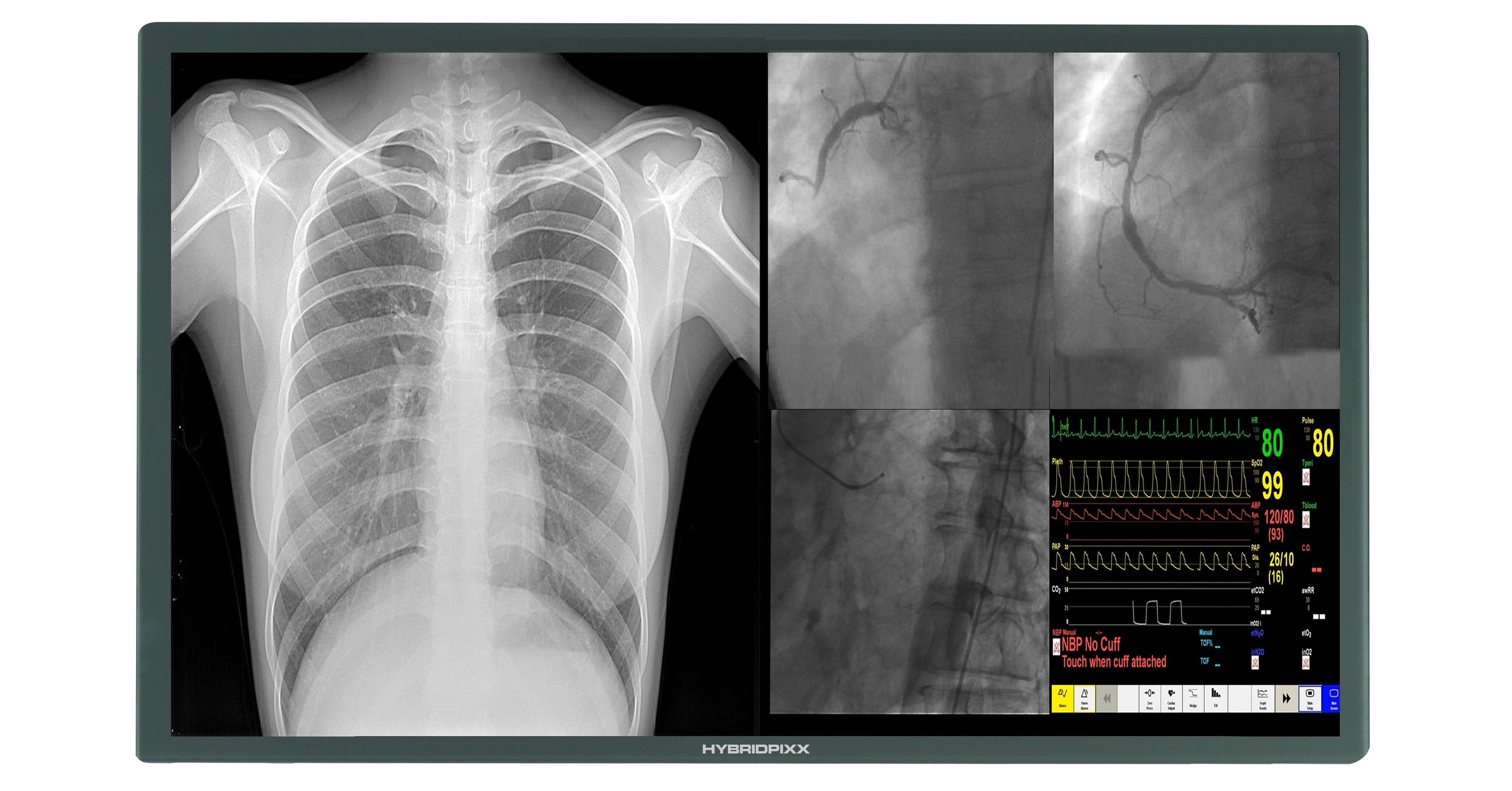 HD 4K 8MP Cath Lab Display Monitor LCD/LED Screens See Superior