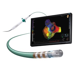 Abbott Announces CE Mark for TactiCath™ Contact Force Ablation Catheter, Sensor Enabled™
