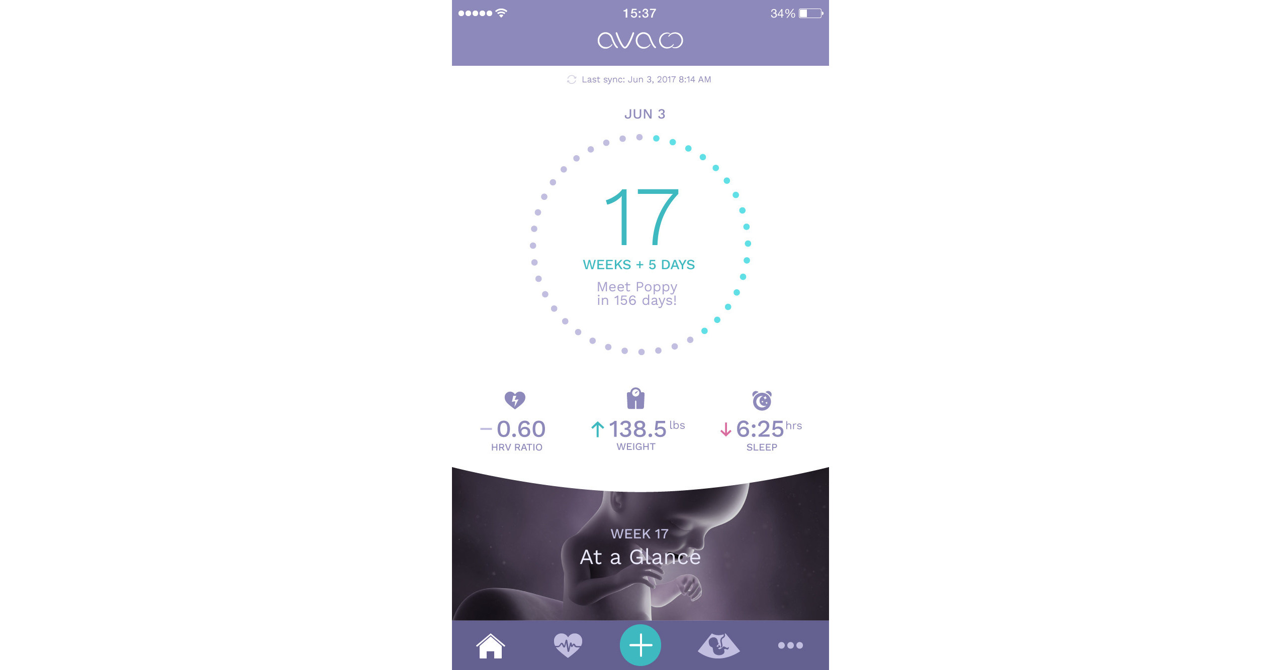 Fertility Tracking Wearable Ava Unveils First Results of Clinical