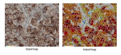 PD-L1 Test Performed with ASIs HiPath (PRNewsfoto/Applied Spectral Imaging (ASI))