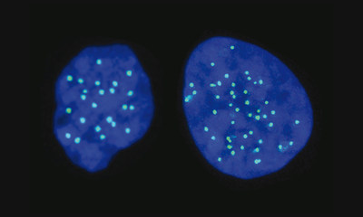 Haploid cell on the left (with 23 chromosomes); Diploid cell on the right (with 46 chromosomes)