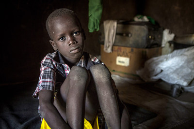 Deng, 7, was separated from his mother during violence in South Sudan. Photo by Jonathan Hyams/Save the Children.