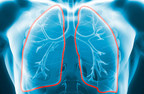 Lung Therapeutics, Inc. Raises $14.3 Million Series B Financing to Treat Unmet Needs in Lung Disease and Fibrosis