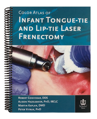 First of Its Kind Book About Infant Laser Frenectomies  Image