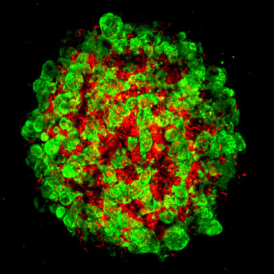 This confocal microscopic image shows detailed development of a human liver organoid tissue-engineered by scientists with human pluripotent stem cells (hPSCs). Green sections of the image show forming hepatic tissues and red sections show developing blood vessels. Reporting their research results in Nature, scientists are developing the miniature organs for their potential to study and treat liver disease.