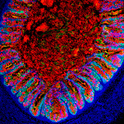 This confocal microscopic image shows a human colon organoid generated in the laboratory with human pluripotent stem cells. The organoid is shown after it was transplanted into a mouse. The engineered colon secreted proteins found in natural human colon, according to a study published by Cell Stem Cell.