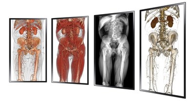 Anatomage Inc. launches the Anatomage Wall, the latest product on the market for visualizing 3D anatomy, system-by-system, side-by-side.