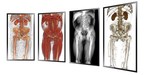 Anatomage Inc. Introduces the Anatomage Wall: Virtually Dissect and View 3D Internal Comparative Anatomy Side-By-Side