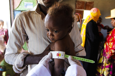 Babies and children in Hodeida, in the north west of Yemen, are suffering from malnutrition and disease. Yemen imports 90% of its food, a lot of which comes through Hodeida but the port has been damaged during fighting. It is the poorest part of Yemen and is therefore suffering some of the worst malnutrition in the country.