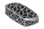 4WEB Medical Announces First U.S. Surgeries with 3D Printed Lateral Spine Truss System