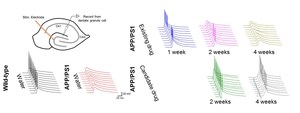 Korea Institute of Science and Technology (KIST) Develops a New Drug for Alzheimer's Disease