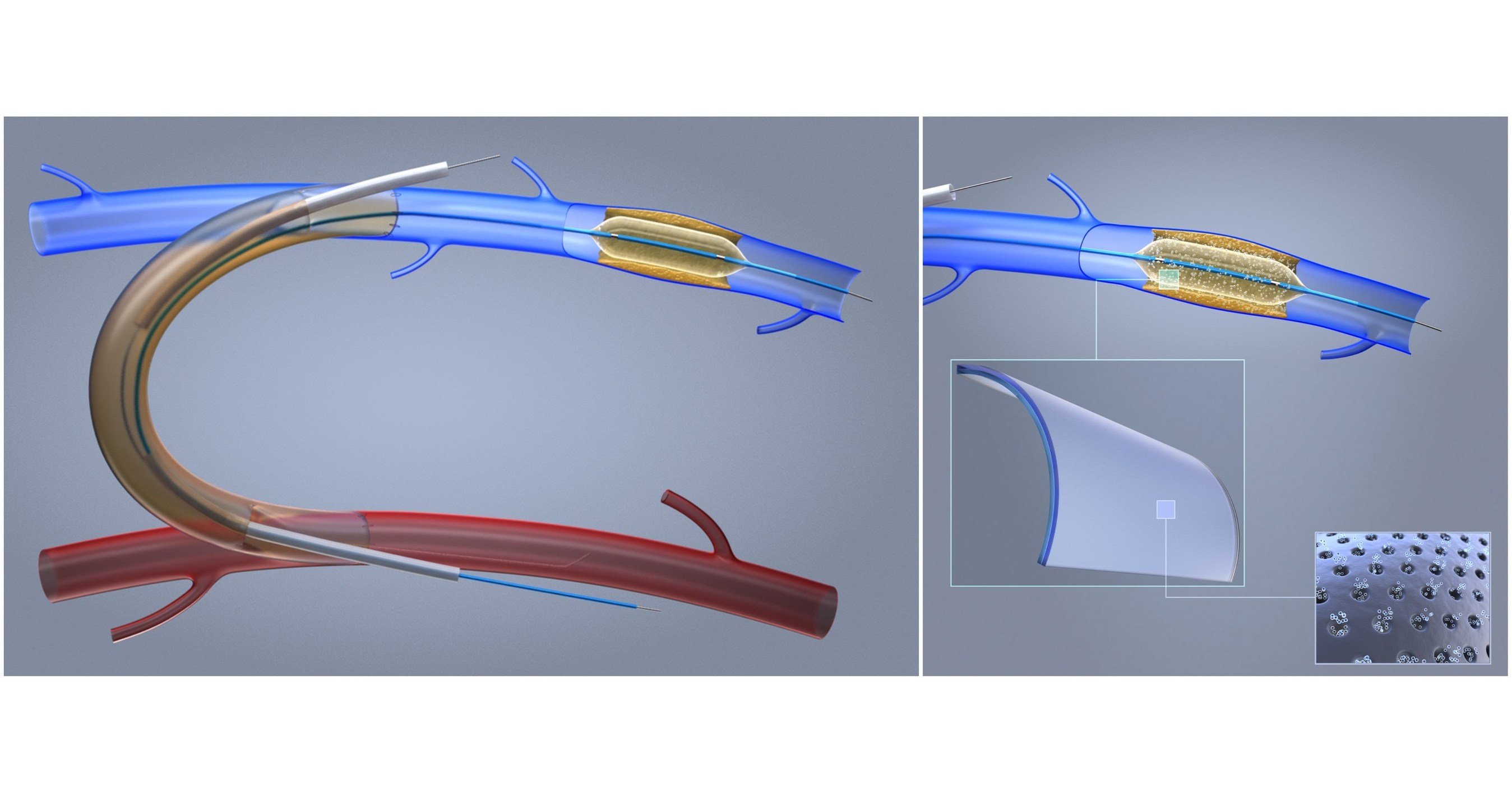 Nexeon Receives Research Grant from National Institutes of Health