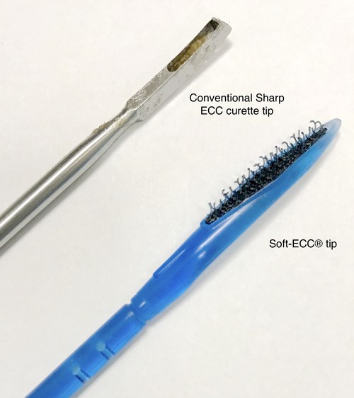 UPDATE Research Supports Compassionate New Biopsy Approach for Women's Health in Cervical