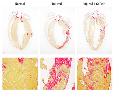 This multi-panel image shows mouse hearts tested by scientists reporting on an experimental therapy for heart damage in a study in the Journal of American College of Cardiology. The bottom row shows closeups of each test. The left panels show a normal uninjured mouse heart, the middle panels are an injured mouse heart with significant scarring and structural damage. The right panels show a heart treated with an experimental molecular inhibitor that stopped the disease process.