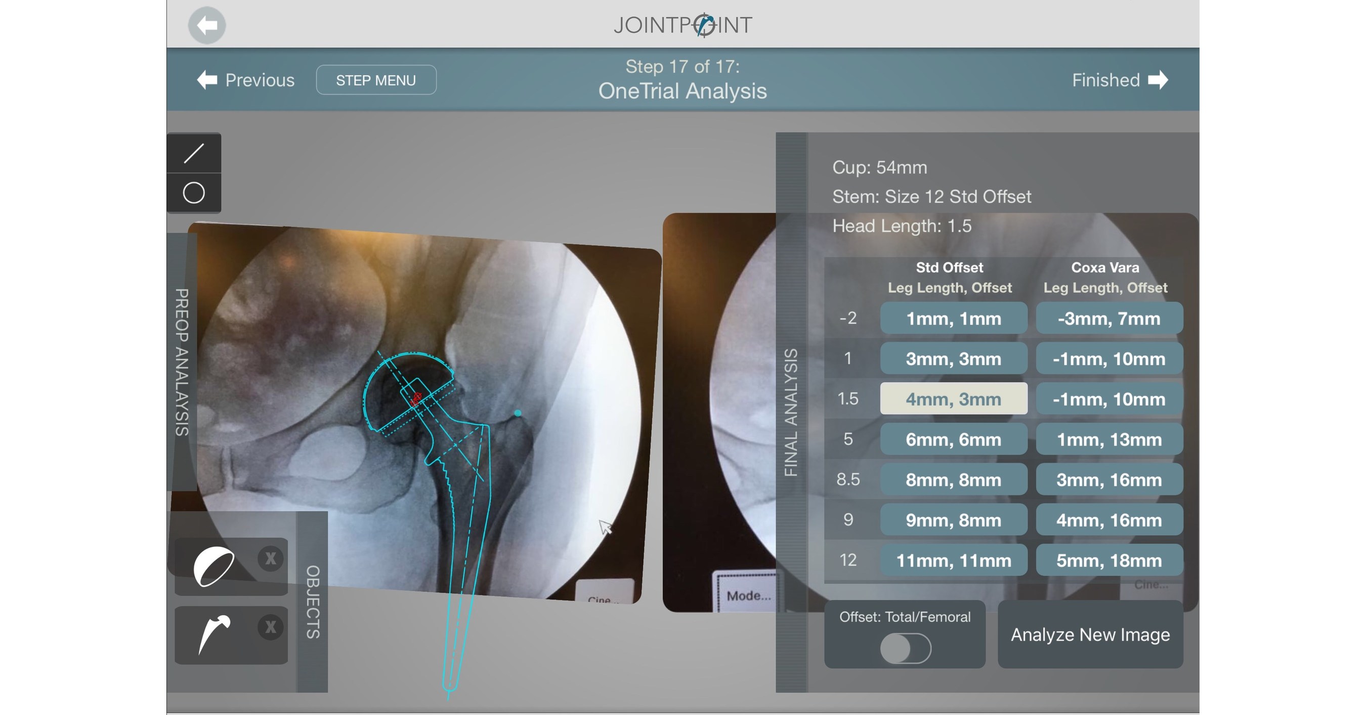 Hip Replacement & Reconstruction Solutions, DePuy Synthes