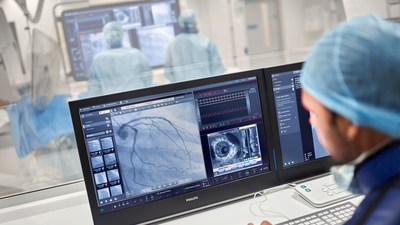 Azurion image-guided therapy platform with intravascular ultrasound (IVUS) technology