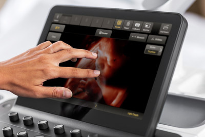 Philips TouchVue is an easy, more intuitive method of 3D volume manipulation. Using simple finger gestures on the system's touch panel, the user can control 3D volume rotation and light source position.