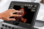 Philips introduces new OB/GYN ultrasound innovations at ISUOG 2017