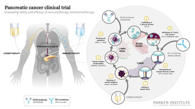 The first patients have begun treatment in a new pancreatic cancer clinical trial sponsored by the Parker Institute for Cancer Immunotherapy. The study explores the combination of standard of care chemotherapy and two immunotherapies, a PD-1 checkpoint inhibitor and a novel CD40 antibody. Cancer immunotherapy utilizes the immune system to tackle tumors.