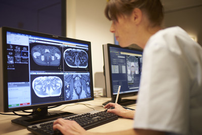 RTdrive MR Prostate, an automated workflow solution, streamlines the process from MR imaging to treatment planning minimal user input, saving valuable time and effort.