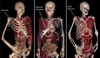 Virtually Dissect Real Human Anatomy With Anatomage's Advanced Visualization Software