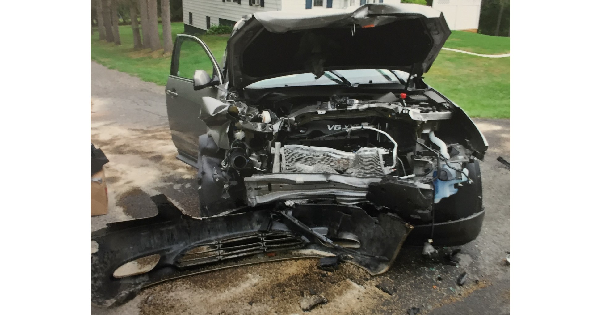 Record Setting 71 Million Verdict For Spinal Injury Suffered In New