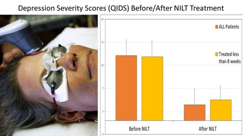 Depression Severity Scores (QIDS) Before/After NILT Treatment