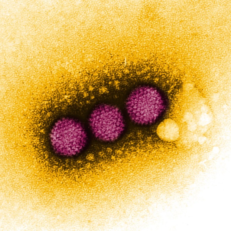 Viruses can be used in gene therapy applications to transfer therapeutic genes