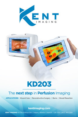 Kent Imaging KD203 – the next step in perfusion imaging (CNW Group/Kent Imaging Inc.)