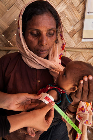 Les taux de malnutrition chez les enfants rohingyas réfugiés au Bangladesh est deux fois supérieurs aux premières estimations