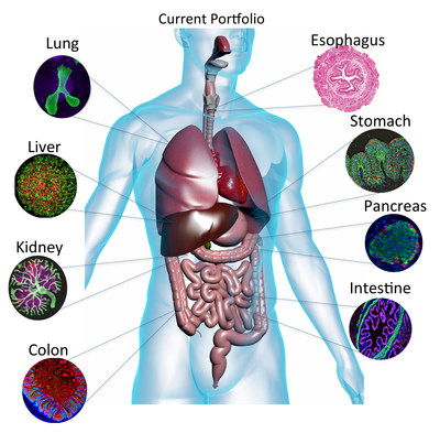 This illustration shows the different human “mini” organs and tissues that scientists at Cincinnati Children’s currently bioengineer in the laboratory, or are working to generate in the near future, with induced pluripotent stem cells. The medical center is establishing the Center for Stem Cell & Organoid Medicine to accelerate the transfer of this technology into patient care.  Credit: Cincinnati Children’s