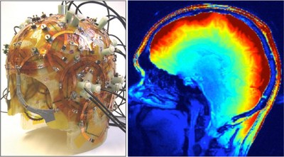 Riccardo Lattanzi, one of the young researchers selected for the prestigious National Academy of Engineering Frontiers of Engineering conference, is trying to improve diagnoses by understanding and exploiting the interaction of electromagnetic fields with tissues in MRI. At left is a 32-channel MRI coil prototype developed by his research group to detect magnetic fields. The illustration at right shows the measured distribution of the magnetic field in the brain tissue.