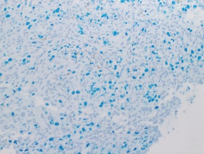Skin tissue at 20X magnification using Roche's DISCOVERY Teal HRP