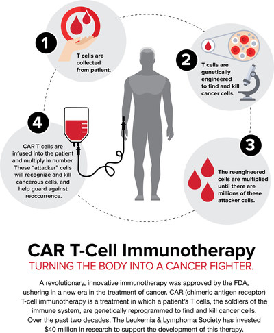 CAR T-Cell Immunotherapy