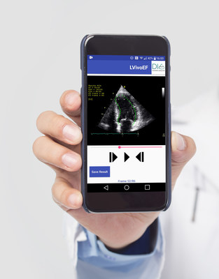 DiA's automated tools for ultrasound analysis on mobile devices