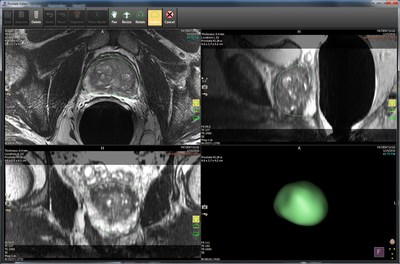 IntelliSpace Portal 10 has been expanded with the DynaCAD Prostate solution through integration with InVivo.