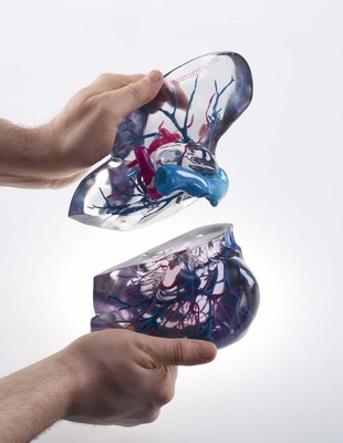 Stratasys  3D  Printed  medical  model  built  with  PolyJet  technology.  This  3D  printed  liver  model  can  be  used  for  live  donor  liver  transplants.  These  3D  printed  medical  models  mitigate  risks  by  enabling  physicians  to  see  hidden  critical  structures.