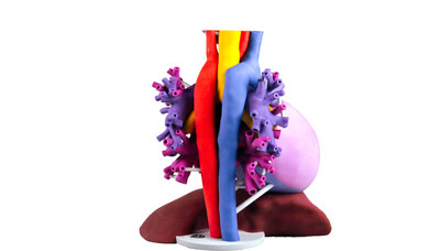 3D Systems' Patient-specific anatomical model takes 2D medical imaging data to 3D for improved visualization using the ProJet(TM) CJP 660Pro.