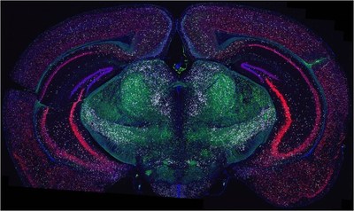 Three-plex detection of glutaminergic neurons, Vglut1 (Red), Vglut2 (Green), and GABAergic neurons Vgat (white) expression in the FFPE mouse brain with RNAscope® Multiplex Fluorescent Assay v2. Nuclei were labelled with DAPI (Blue)