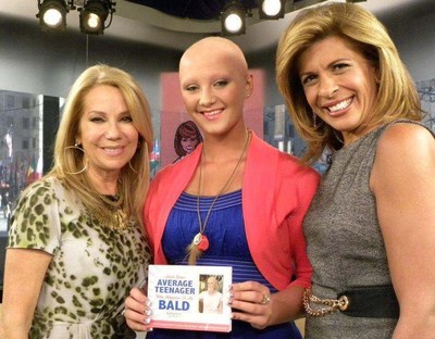 Movoto's Sandy Rusk Raises Awareness About Alopecia