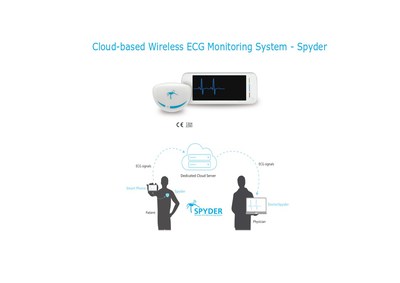 Cloud-based Wireless ECG Monitoring System - Spyder