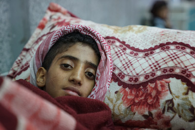 A young boy lies in the emergency room awaiting treatment for suspected cholera at the Al-Joumhouri Hospital, Sana'a, Yemen, Wednesday 3 May 2017.  UNICEF/UN073966/Clarke for UNOCHA (CNW Group/UNICEF Canada)