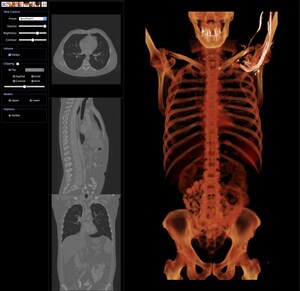 Anatomage Inc. Launches Cloud Platform For Easy Medical Image Sharing