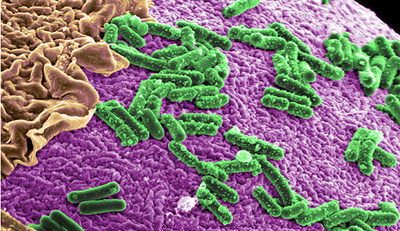 https://mma.prnewswire.com/media/626338/Evelo_Biosciences_Microbiome.jpg?p=caption