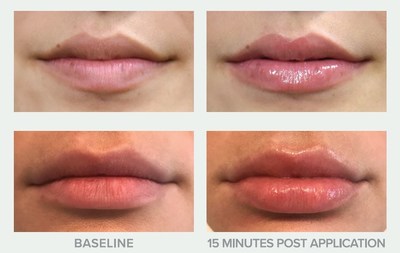 Replenix Plumping Lip Treatment SPF 30 helps to restore youthful volume, hydration and color.  Immediately lips appear more plump and defined.