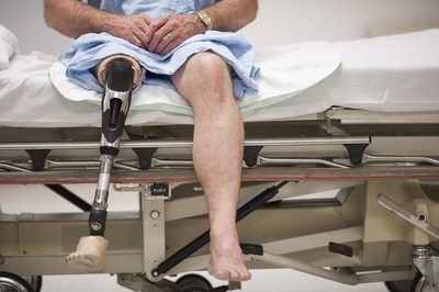US Drug Watchdog Now Urges Persons Who Used the Type Two Diabetes Drug Invokana and Suffered Kidney Failure or a Below the Knee Amputation to Call Them About Possible Significant Compensation
